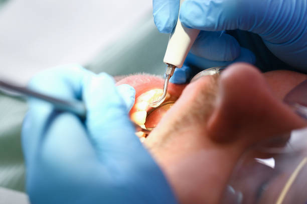 Best Emergency Dentist Near Me  in Mount Vernon, TX