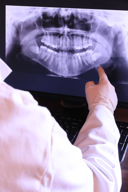 Best Dentist for Tooth Abscess  in Mount Vernon, TX